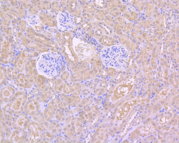 Immunohistochemical analysis of paraffin-embedded mouse kidney tissue using anti-HDAC3 antibody. The section was pre-treated using heat mediated antigen retrieval with Tris-EDTA buffer (pH 8.0-8.4) for 20 minutes.The tissues were blocked in 5% BSA for 30 minutes at room temperature, washed with ddH2O and PBS, and then probed with the primary antibody (M1511-3, 1/200) for 30 minutes at room temperature. The detection was performed using an HRP conjugated compact polymer system. DAB was used as the chromogen. Tissues were counterstained with hematoxylin and mounted with DPX.