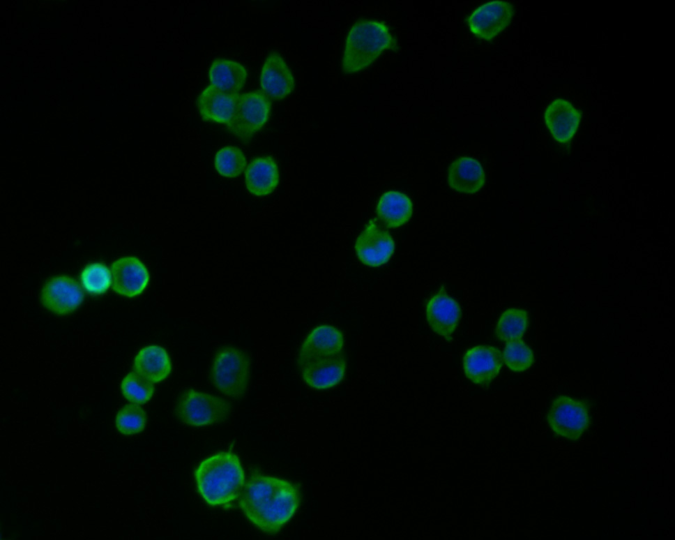 ICC staining of PSD95 in N2A cells (green). Formalin fixed cells were permeabilized with 0.1% Triton X-100 in TBS for 10 minutes at room temperature and blocked with 1% Blocker BSA for 15 minutes at room temperature. Cells were probed with the primary antibody (M1511-4, 1/100) for 1 hour at room temperature, washed with PBS. Alexa Fluor®488 Goat anti-Mouse IgG was used as the secondary antibody at 1/1,000 dilution. The nuclear counter stain is DAPI (blue).
