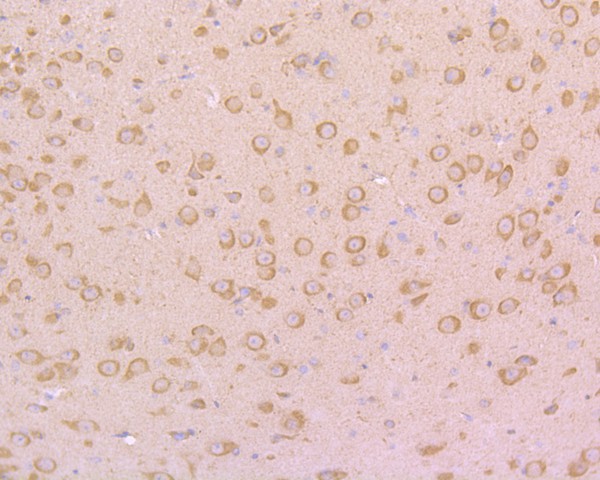 Immunohistochemical analysis of paraffin-embedded mouse brain tissue using anti-PSD95 antibody. The section was pre-treated using heat mediated antigen retrieval with Tris-EDTA buffer (pH 8.0-8.4) for 20 minutes.The tissues were blocked in 5% BSA for 30 minutes at room temperature, washed with ddH2O and PBS, and then probed with the primary antibody (M1511-4, 1/200) for 30 minutes at room temperature. The detection was performed using an HRP conjugated compact polymer system. DAB was used as the chromogen. Tissues were counterstained with hematoxylin and mounted with DPX.