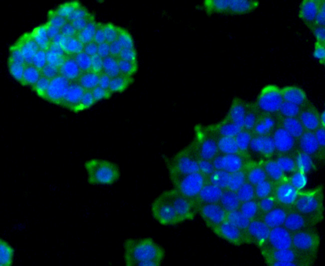 ICC staining Cyclin A2 in PC-12 cells (green). The nuclear counter stain is DAPI (blue). Cells were fixed in paraformaldehyde, permeabilised with 0.25% Triton X100/PBS.