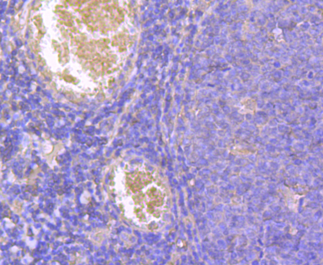 Immunohistochemical analysis of paraffin-embedded human tonsil tissue using anti-Cyclin A2 antibody. Counter stained with hematoxylin.