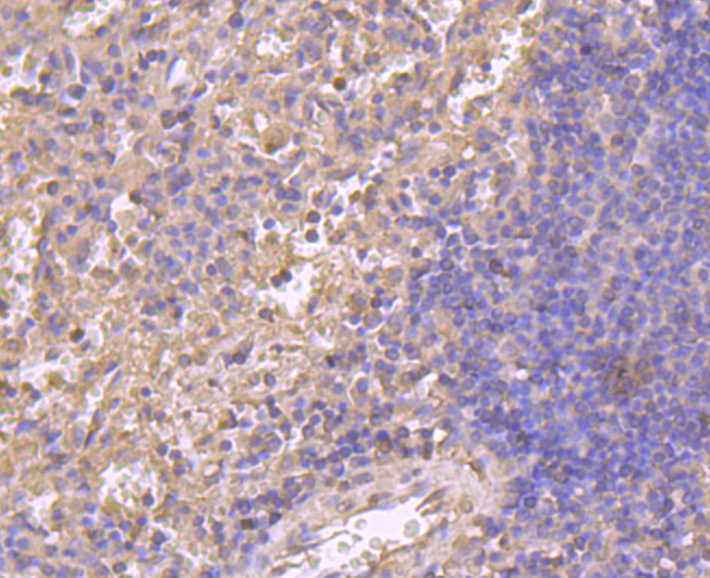 Immunohistochemical analysis of paraffin-embedded human spleen tissue using anti-Cyclin A2 antibody. Counter stained with hematoxylin.
