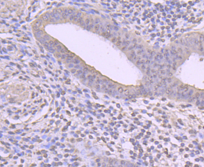 Immunohistochemical analysis of paraffin-embedded human uterus tissue using anti-Cyclin A2 antibody. Counter stained with hematoxylin.