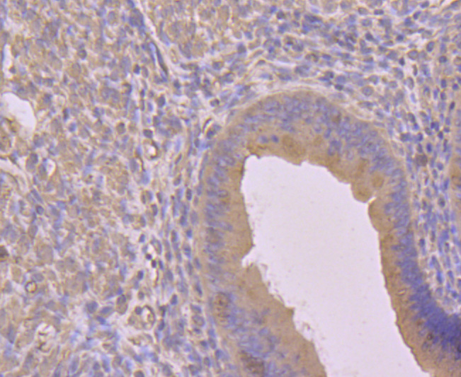 Immunohistochemical analysis of paraffin-embedded mouse uterus tissue using anti-Cyclin A2 antibody. Counter stained with hematoxylin.