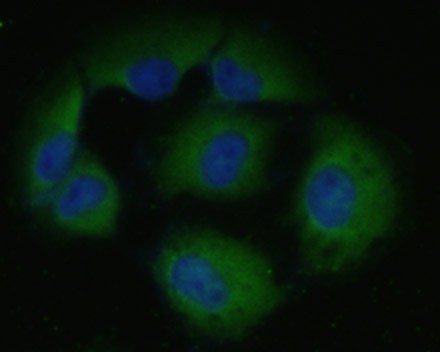 ICC staining of ICAM-1 in HUVEC cells (green). Formalin fixed cells were permeabilized with 0.1% Triton X-100 in TBS for 10 minutes at room temperature and blocked with 1% Blocker BSA for 15 minutes at room temperature. Cells were probed with the primary antibody (M1511-6, 1/50) for 1 hour at room temperature, washed with PBS. Alexa Fluor®488 Goat anti-Mouse IgG was used as the secondary antibody at 1/1,000 dilution. The nuclear counter stain is DAPI (blue).