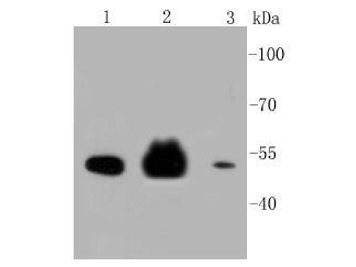 Western blot analysis on different cell lysates using anti-Cytokeratin 8 Mouse mAb. Positive control: <br />
Lane 1: A549      <br />
Lane 2: MCF-7 <br />
Lane 3: PC12