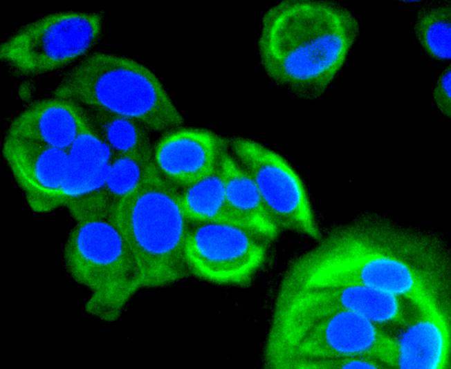 Immunocytochemical staining of MCF-7 cells using anti-Cytokeratin 8 Mouse mAb.