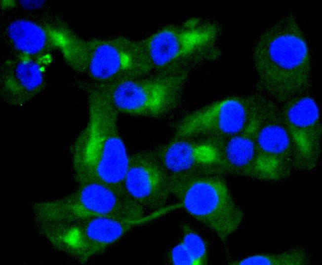 Immunocytochemical staining of PANC-1 cells using anti-Cytokeratin 8 Mouse mAb.