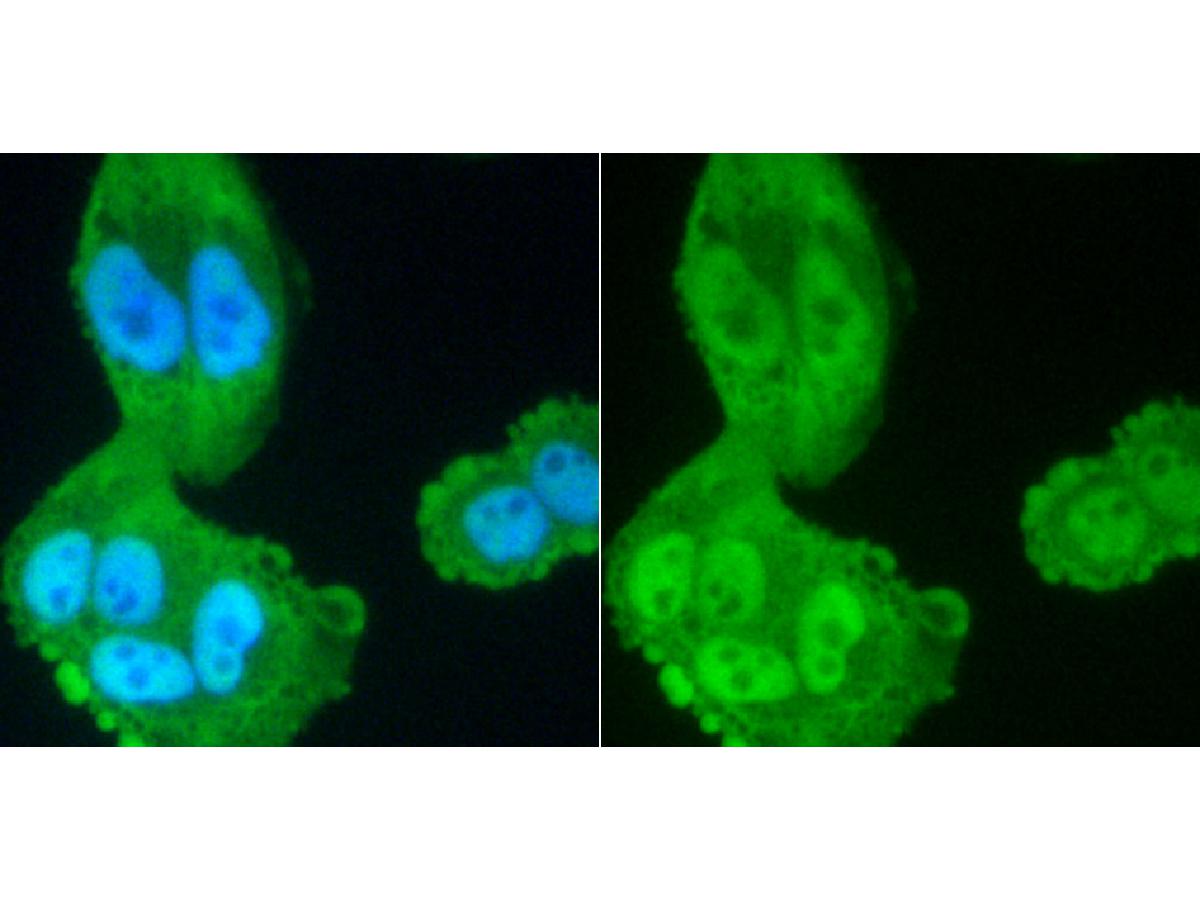 ICC staining PP2A(alpha+beta) (green) in Hela cells. The nuclear counter stain is DAPI (blue). Cells were fixed in paraformaldehyde, permeabilised with 0.25% Triton X100/PBS.