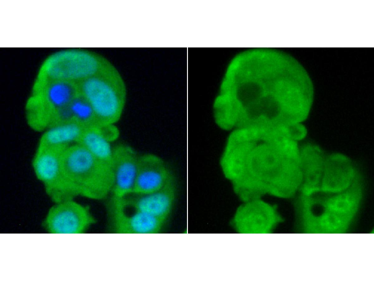 ICC staining PP2A(alpha+beta) (green) in MCF-7 cells. The nuclear counter stain is DAPI (blue). Cells were fixed in paraformaldehyde, permeabilised with 0.25% Triton X100/PBS.
