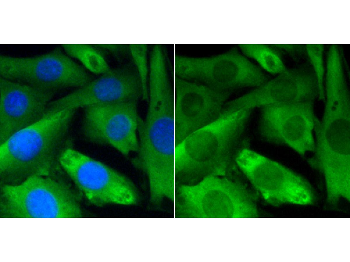 ICC staining PP2A(alpha+beta) (green) in SHG-44 cells. The nuclear counter stain is DAPI (blue). Cells were fixed in paraformaldehyde, permeabilised with 0.25% Triton X100/PBS.