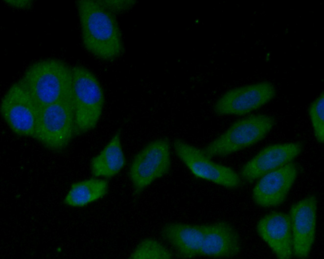 ICC staining of LAMP2 in HepG2 cells (green). Formalin fixed cells were permeabilized with 0.1% Triton X-100 in TBS for 10 minutes at room temperature and blocked with 1% Blocker BSA for 15 minutes at room temperature. Cells were probed with the primary antibody (M1603-5, 1/50) for 1 hour at room temperature, washed with PBS. Alexa Fluor®488 Goat anti-mouse IgG was used as the secondary antibody at 1/100 dilution. The nuclear counter stain is DAPI (blue).