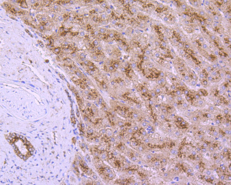Immunohistochemical analysis of paraffin-embedded human liver tissue using anti-LAMP2 antibody. The section was pre-treated using heat mediated antigen retrieval with Tris-EDTA buffer (pH 8.0-8.4) for 20 minutes.The tissues were blocked in 5% BSA for 30 minutes at room temperature, washed with ddH2O and PBS, and then probed with the primary antibody (M1603-5, 1/200) for 30 minutes at room temperature. The detection was performed using an HRP conjugated compact polymer system. DAB was used as the chromogen. Tissues were counterstained with hematoxylin and mounted with DPX.