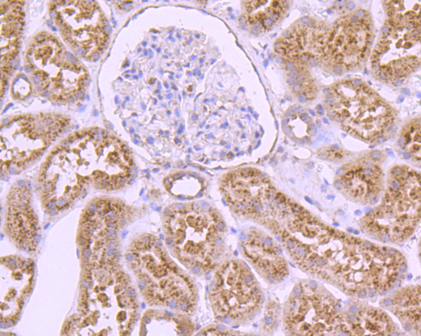Immunohistochemical analysis of paraffin-embedded human kidney tissue using anti-LAMP2 antibody. The section was pre-treated using heat mediated antigen retrieval with Tris-EDTA buffer (pH 8.0-8.4) for 20 minutes.The tissues were blocked in 5% BSA for 30 minutes at room temperature, washed with ddH2O and PBS, and then probed with the primary antibody (M1603-5, 1/200) for 30 minutes at room temperature. The detection was performed using an HRP conjugated compact polymer system. DAB was used as the chromogen. Tissues were counterstained with hematoxylin and mounted with DPX.