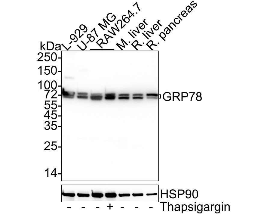 Western blot analysis of GRP78 / BIP on different lysates with Mouse anti-GRP78 / BIP antibody (M1701-1) at 1/1,000 dilution.<br />
<br />
Lane 1: L-929 cell lysate<br />
Lane 2: U-87 MG cell lysate<br />
Lane 3: RAW264.7 cell lysate<br />
Lane 4: RAW264.7 treated with 300nM Thapsigargin for 18 hours cell lysate<br />
Lane 5: Mouse liver tissue lysate<br />
Lane 6: Rat liver tissue lysate<br />
Lane 7: Rat pancreas tissue lysate<br />
<br />
Lysates/proteins at 30 µg/Lane.<br />
<br />
Predicted band size: 72 kDa<br />
Observed band size: 70/72 kDa<br />
<br />
Exposure time: 6 seconds; ECL: K1801;<br />
<br />
4-20% SDS-PAGE gel.<br />
<br />
Proteins were transferred to a PVDF membrane and blocked with 5% NFDM/TBST for 1 hour at room temperature. The primary antibody (M1701-1) at 1/1,000 dilution was used in 5% NFDM/TBST at 4℃ overnight. Goat Anti-Mouse IgG - HRP Secondary Antibody (HA1006) at 1/50,000 dilution was used for 1 hour at room temperature.