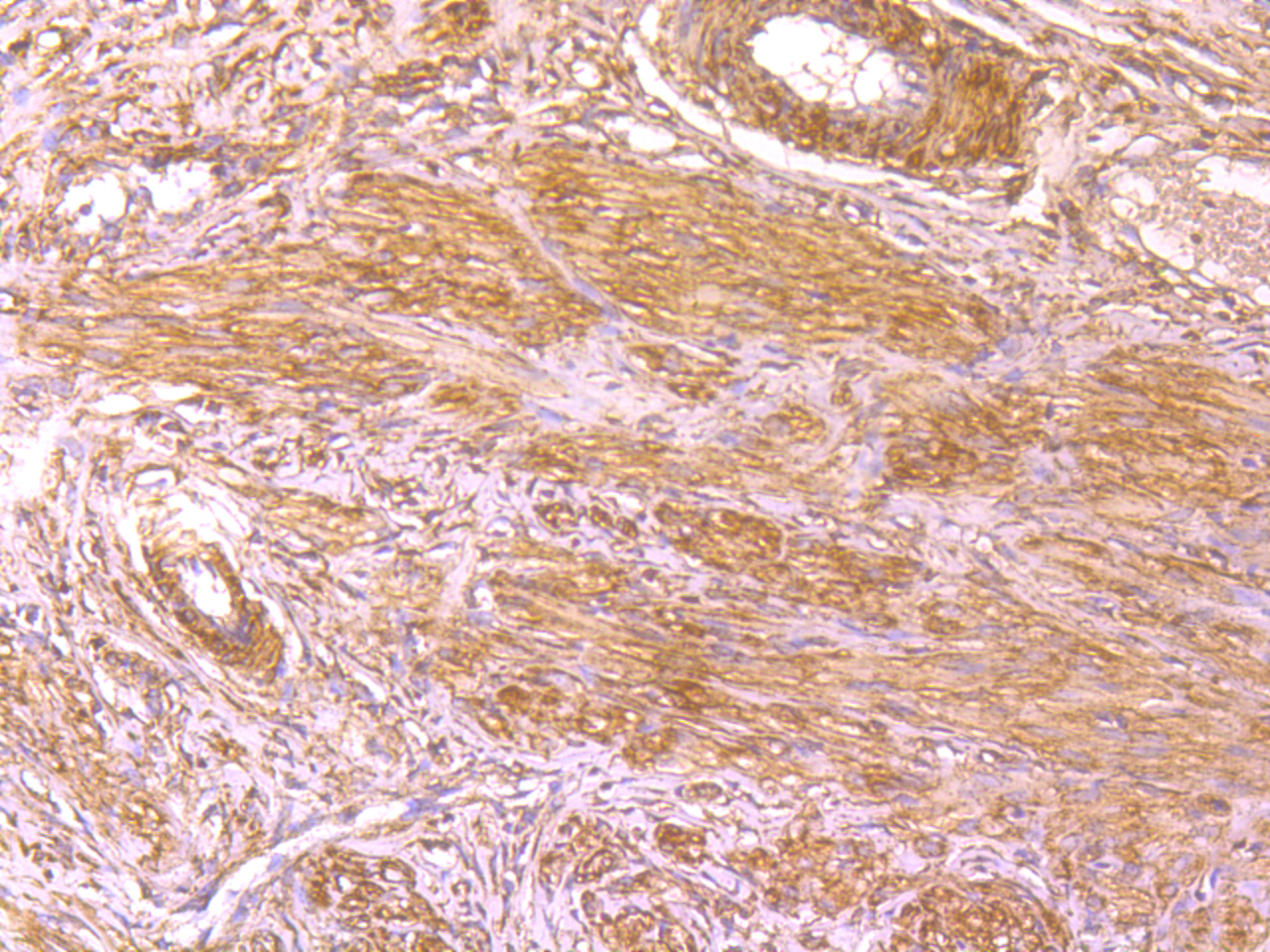 Immunohistochemical analysis of paraffin-embedded rat cervix tissue using anti-BLCAP antibody. Counter stained with hematoxylin.