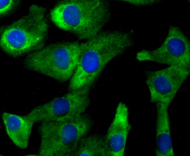 ICC staining CD137 (green) in A549 cells. The nuclear counter stain is DAPI (blue). Cells were fixed in paraformaldehyde, permeabilised with 0.25% Triton X100/PBS.