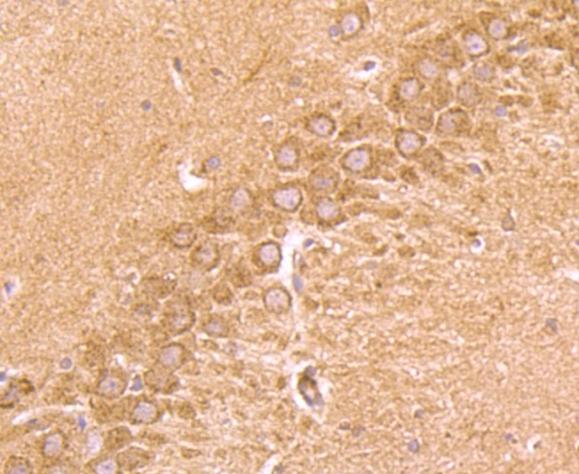 Immunohistochemical analysis of paraffin-embedded rat hippocampus tissue using anti-CD137 antibody. Counter stained with hematoxylin.