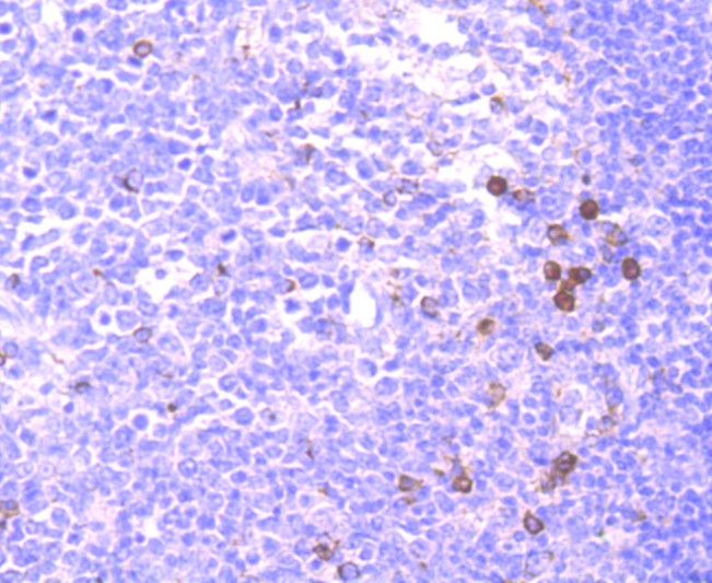 Immunohistochemical analysis of paraffin-embedded human tonsil tissue using anti-CD137 antibody. Counter stained with hematoxylin.