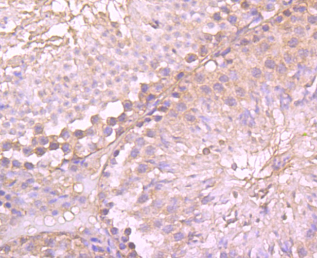 Immunohistochemical analysis of paraffin-embedded mouse testis tissue using anti-gamma tubulin antibody. Counter stained with hematoxylin.