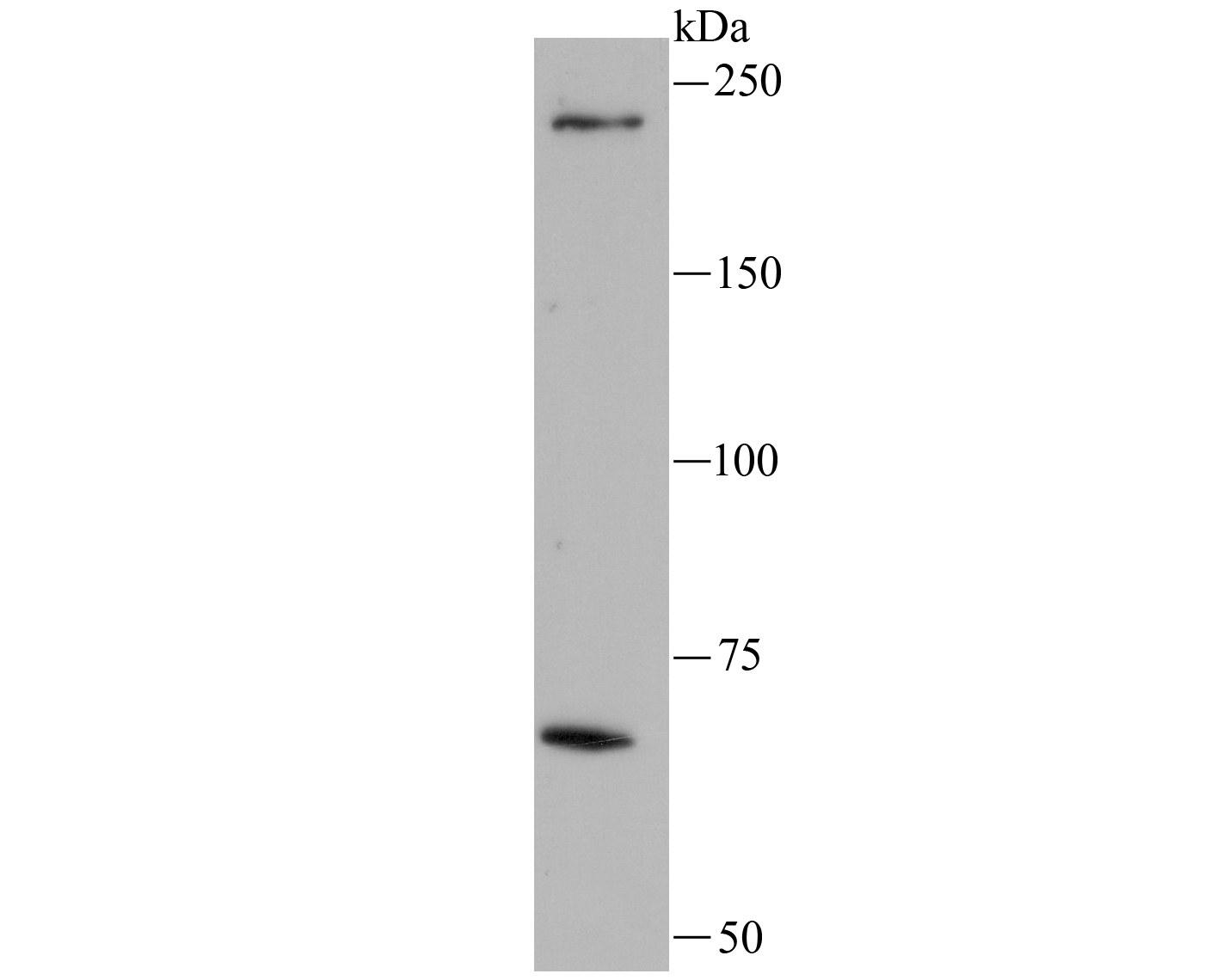 Western blot analysis of LRRK1 on A549 lysate using anti-LRRK1 antibody at 1/100 dilution.