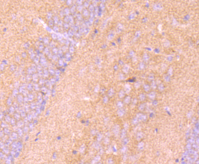 Immunohistochemical analysis of paraffin-embedded mouse brain tissue using anti-LRRK1 antibody. Counter stained with hematoxylin.