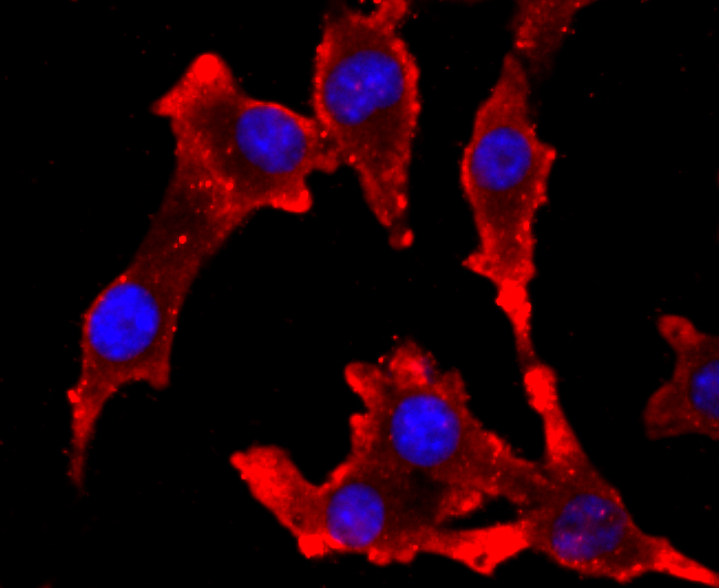 ICC staining tyrosinase in B16F1 cells (red). The nuclear counter stain is DAPI (blue). Cells were fixed in paraformaldehyde, permeabilised with 0.25% Triton X100/PBS.
