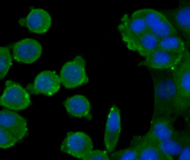 ICC staining of Atg12 in MCF-7 cells (green). Formalin fixed cells were permeabilized with 0.1% Triton X-100 in TBS for 10 minutes at room temperature and blocked with 1% Blocker BSA for 15 minutes at room temperature. Cells were probed with the primary antibody (M1701-4, 1/50) for 1 hour at room temperature, washed with PBS. Alexa Fluor®488 Goat anti-Mouse IgG was used as the secondary antibody at 1/1,000 dilution. The nuclear counter stain is DAPI (blue).