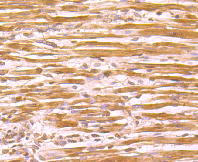 Immunohistochemical analysis of paraffin-embedded human fetal skeletal muscle tissue using anti-Atg12 antibody. The section was pre-treated using heat mediated antigen retrieval with sodium citrate buffer (pH 6.0) for 20 minutes. The tissues were blocked in 5% BSA for 30 minutes at room temperature, washed with ddH2O and PBS, and then probed with the primary antibody (M1701-4, 1/50) for 30 minutes at room temperature. The detection was performed using an HRP conjugated compact polymer system. DAB was used as the chromogen. Tissues were counterstained with hematoxylin and mounted with DPX.