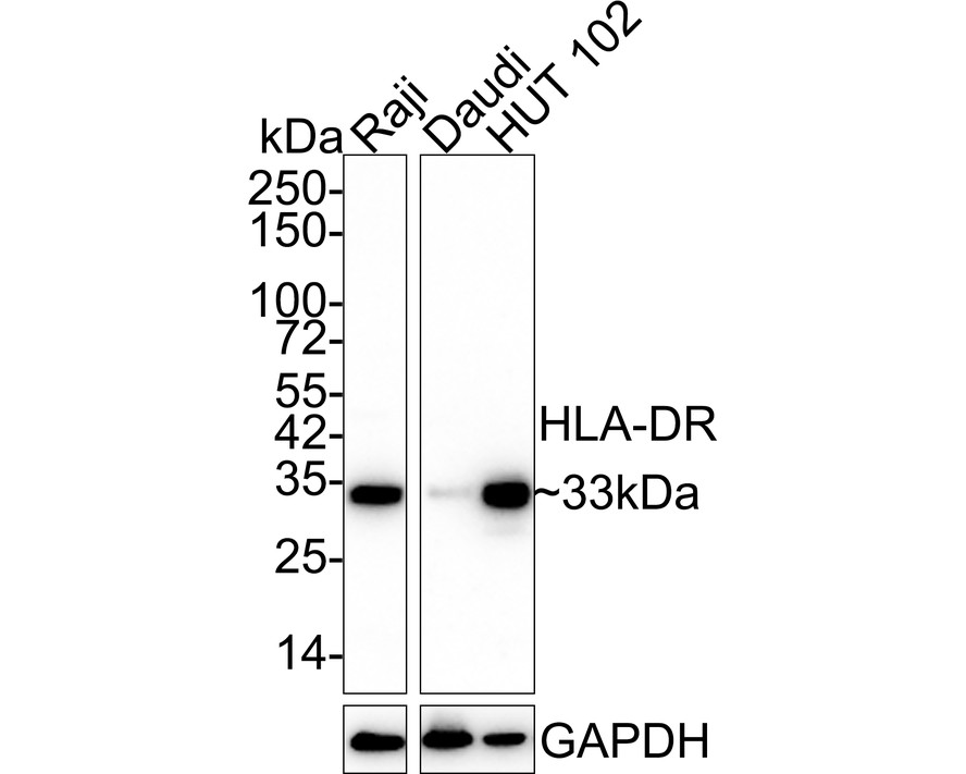 Western blot analysis of HLA-DR on different lysates with Mouse anti-HLA-DR antibody (M1701-5) at 1/1,000 dilution.<br />
<br />
Lane 1: Raji cell lysate<br />
Lane 2: Daudi cell lysate<br />
Lane 3: HUT 102 cell lysate<br />
<br />
Lysates/proteins at 20 µg/Lane.<br />
<br />
Predicted band size: 29 kDa<br />
Observed band size: 33 kDa<br />
<br />
Exposure time: 43 seconds;<br />
<br />
4-20% SDS-PAGE gel.<br />
<br />
Proteins were transferred to a PVDF membrane and blocked with 5% NFDM/TBST for 1 hour at room temperature. The primary antibody (M1701-5) at 1/1,000 dilution was used in 5% NFDM/TBST at 4℃ overnight. Goat Anti-Mouse IgG - HRP Secondary Antibody (HA1006) at 1/50,000 dilution was used for 1 hour at room temperature.