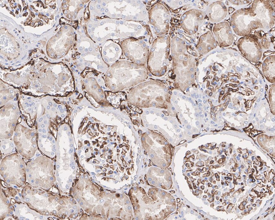 Immunohistochemical analysis of paraffin-embedded human kidney tissue with Mouse anti-HLA-DR antibody (M1701-5) at 1/1,000 dilution.<br />
<br />
The section was pre-treated using heat mediated antigen retrieval with Tris-EDTA buffer (pH 9.0) for 20 minutes. The tissues were blocked in 1% BSA for 20 minutes at room temperature, washed with ddH2O and PBS, and then probed with the primary antibody (M1701-5) at 1/1,000 dilution for 1 hour at room temperature. The detection was performed using an HRP conjugated compact polymer system. DAB was used as the chromogen. Tissues were counterstained with hematoxylin and mounted with DPX.