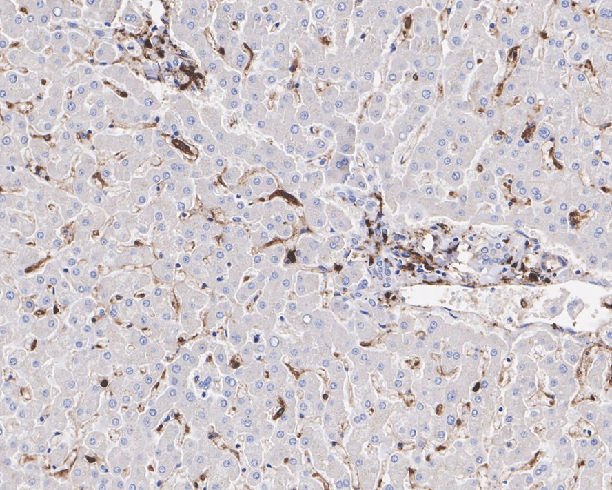 Immunohistochemical analysis of paraffin-embedded human liver tissue with Mouse anti-HLA-DR antibody (M1701-5) at 1/1,000 dilution.<br />
<br />
The section was pre-treated using heat mediated antigen retrieval with Tris-EDTA buffer (pH 9.0) for 20 minutes. The tissues were blocked in 1% BSA for 20 minutes at room temperature, washed with ddH2O and PBS, and then probed with the primary antibody (M1701-5) at 1/1,000 dilution for 1 hour at room temperature. The detection was performed using an HRP conjugated compact polymer system. DAB was used as the chromogen. Tissues were counterstained with hematoxylin and mounted with DPX.