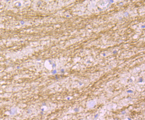 Immunohistochemical analysis of paraffin-embedded rat brain tissue using anti-MAL antibody. Counter stained with hematoxylin.