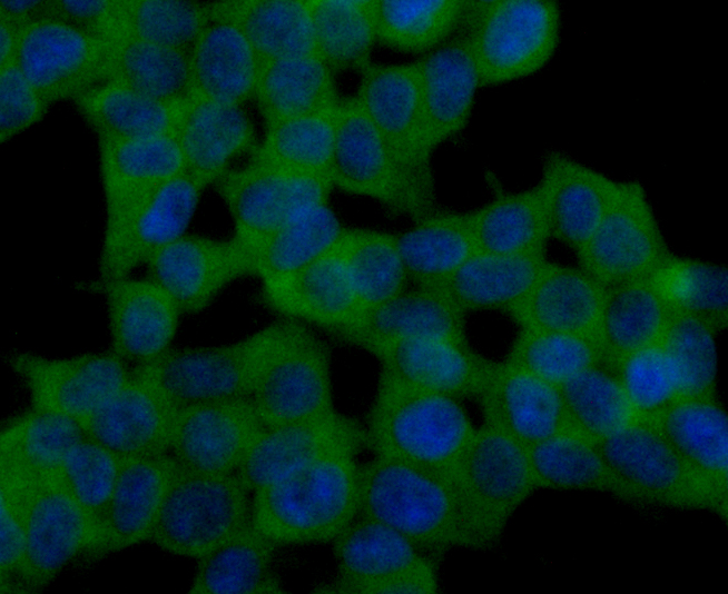 ICC staining GPX5 (green) in 293T cells. The nuclear counter stain is DAPI (blue). Cells were fixed in paraformaldehyde, permeabilised with 0.25% Triton X100/PBS.