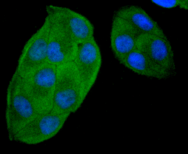 ICC staining GPX5 (green) in Hela cells. The nuclear counter stain is DAPI (blue). Cells were fixed in paraformaldehyde, permeabilised with 0.25% Triton X100/PBS.