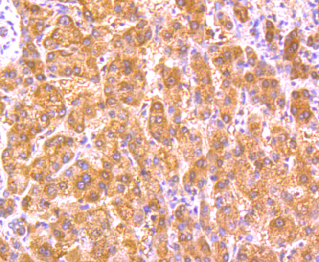 Immunohistochemical analysis of paraffin-embedded human liver tissue using anti-GPX5 antibody. Counter stained with hematoxylin.