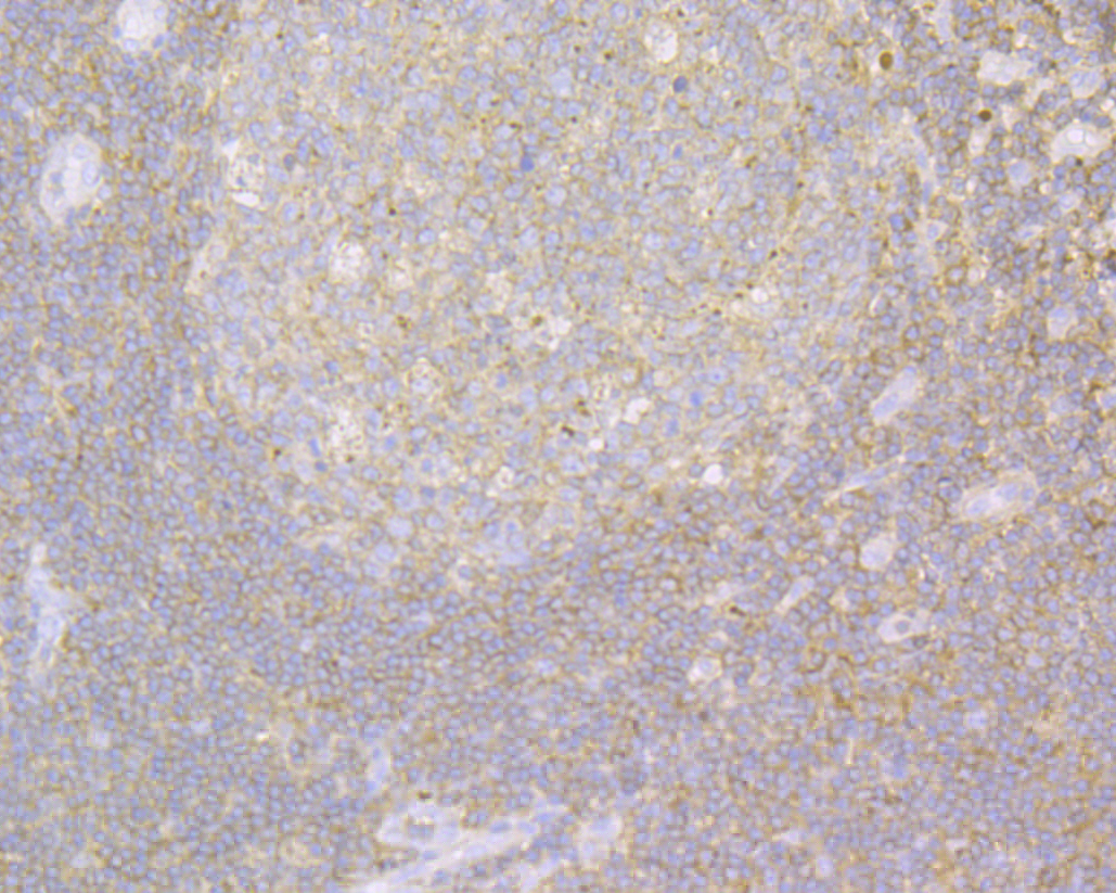 beta Actin Rabbit polyclonal Antibody