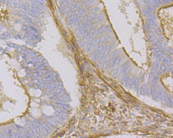 beta Actin Rabbit polyclonal Antibody