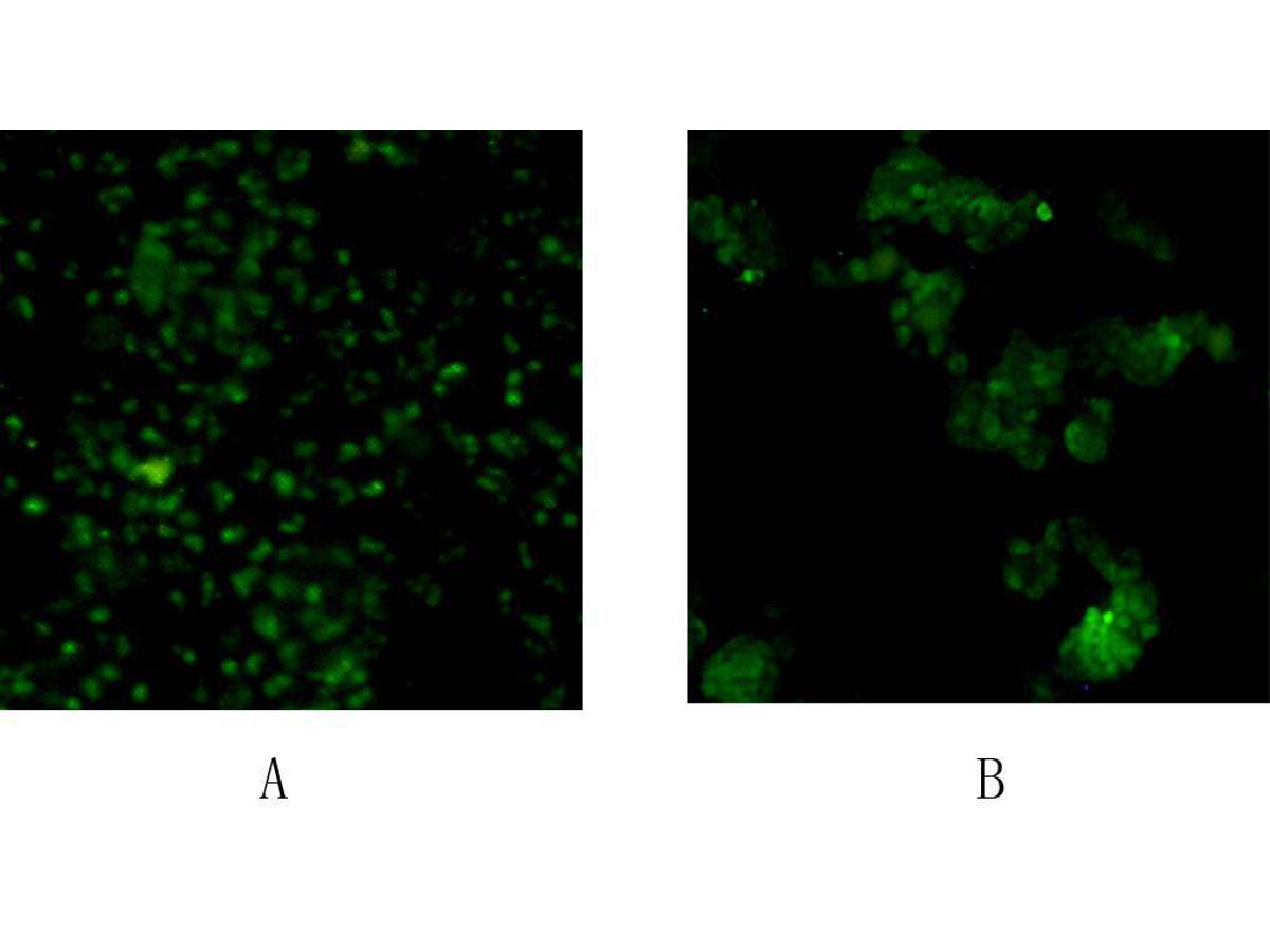 ICC image of SOX2 antibody stained human F9 cells (A) and NCCIT cells (B). The secondary antibody (green) was goat anti-rabbit IgG (H+L) FITC conjugated.