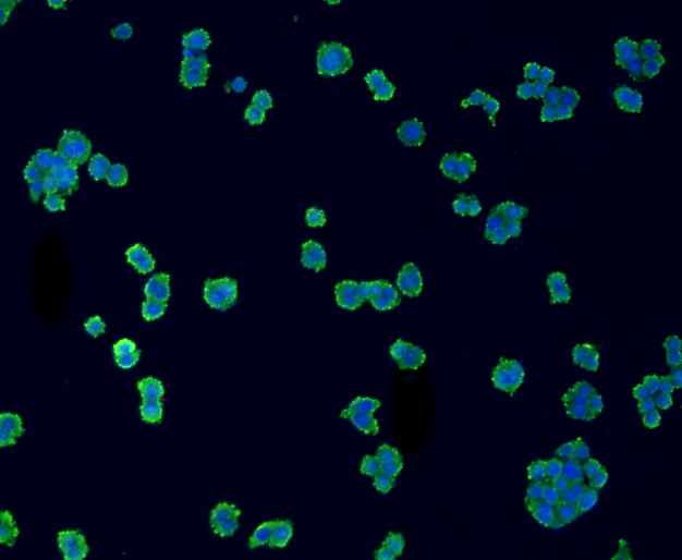 ICC staining CD14 in SW480 cells (green). The nuclear counter stain is DAPI (blue). Cells were fixed in paraformaldehyde, permeabilised with 0.25% Triton X100/PBS.