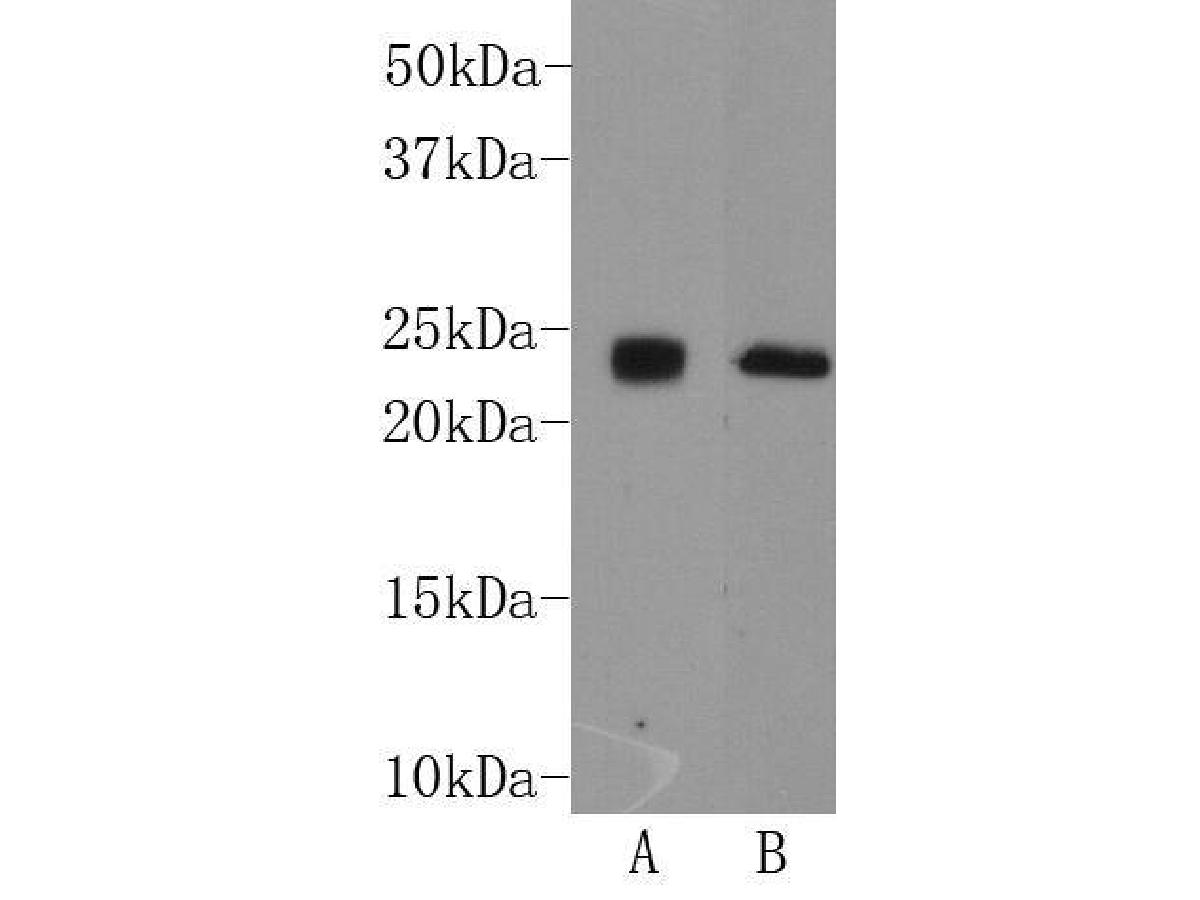 Western blot analysis on mouse brain (A) and human brain (B) tissue lysates using anti-THY-1 rabbit polyclonal antibody.