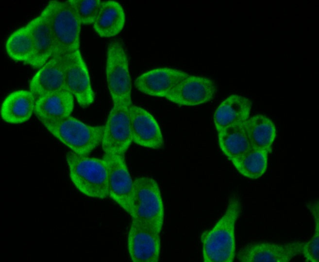 ICC staining GAPDH in LOVO cells (green). Formalin fixed cells were permeabilized with 0.1% Triton X-100 in TBS for 10 minutes at room temperature and blocked with 1% Blocker BSA for 15 minutes at room temperature. Cells were probed with the antibody (R1210-1) at a dilution of 1:100 for 1 hour at room temperature, washed with PBS. Alexa Fluorc™ 488 Goat anti-Rabbit IgG was used as the secondary antibody at 1/100 dilution. The nuclear counter stain is DAPI (blue).