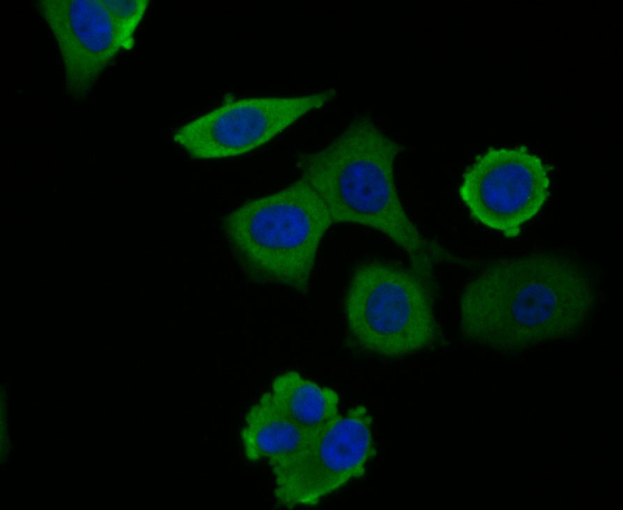 ICC staining GAPDH in MCF-7 cells (green). Formalin fixed cells were permeabilized with 0.1% Triton X-100 in TBS for 10 minutes at room temperature and blocked with 1% Blocker BSA for 15 minutes at room temperature. Cells were probed with the antibody (R1210-1) at a dilution of 1:100 for 1 hour at room temperature, washed with PBS. Alexa Fluorc™ 488 Goat anti-Rabbit IgG was used as the secondary antibody at 1/100 dilution. The nuclear counter stain is DAPI (blue).