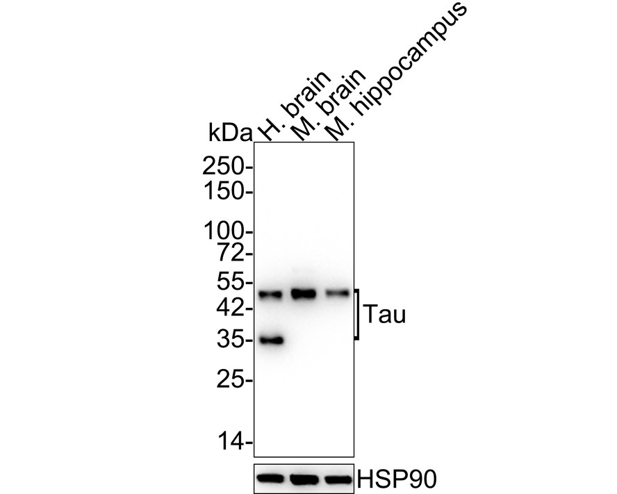 Western blot analysis of Tau on human brain tissue lysate using anti-Tau antibody at 1/1,000 dilution.