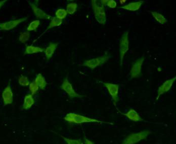 ICC staining Tau in SHG-44 cells (green). The nuclear counter stain is DAPI (blue). Cells were fixed in paraformaldehyde, permeabilised with 0.25% Triton X100/PBS.