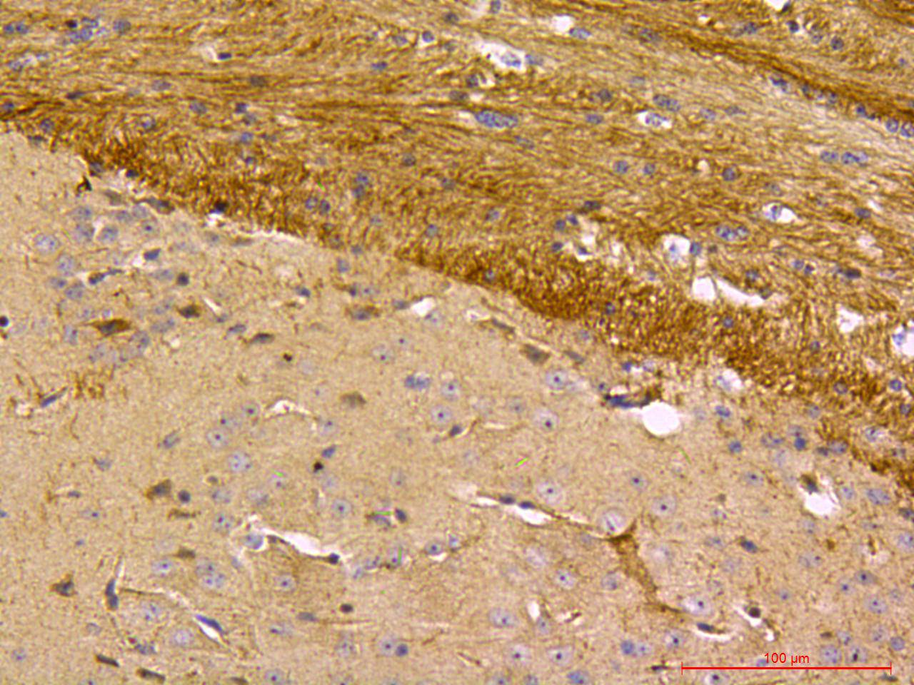 Immunohistochemical analysis of paraffin-embedded mouse brain tissue using anti-Beclin 1 antibody. The section was pre-treated using heat mediated antigen retrieval with sodium citrate buffer (pH 6.0) for 20 minutes. The tissues were blocked in 5% BSA for 30 minutes at room temperature, washed with ddH2O and PBS, and then probed with the primary antibody (R1509-1, 1/50) for 30 minutes at room temperature. The detection was performed using an HRP conjugated compact polymer system. DAB was used as the chromogen. Tissues were counterstained with hematoxylin and mounted with DPX.