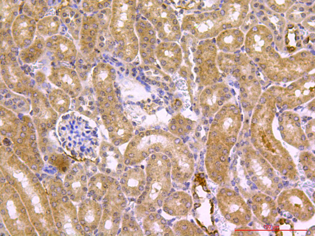 Immunohistochemical analysis of paraffin-embedded mouse kidney tissue using anti-Beclin 1 antibody. The section was pre-treated using heat mediated antigen retrieval with sodium citrate buffer (pH 6.0) for 20 minutes. The tissues were blocked in 5% BSA for 30 minutes at room temperature, washed with ddH2O and PBS, and then probed with the primary antibody (R1509-1, 1/50) for 30 minutes at room temperature. The detection was performed using an HRP conjugated compact polymer system. DAB was used as the chromogen. Tissues were counterstained with hematoxylin and mounted with DPX.