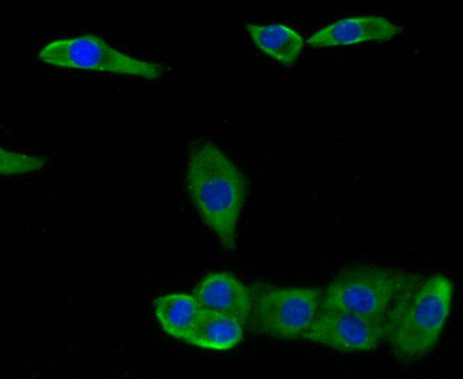 CCL3 Rabbit Polyclonal Antibody - image 2