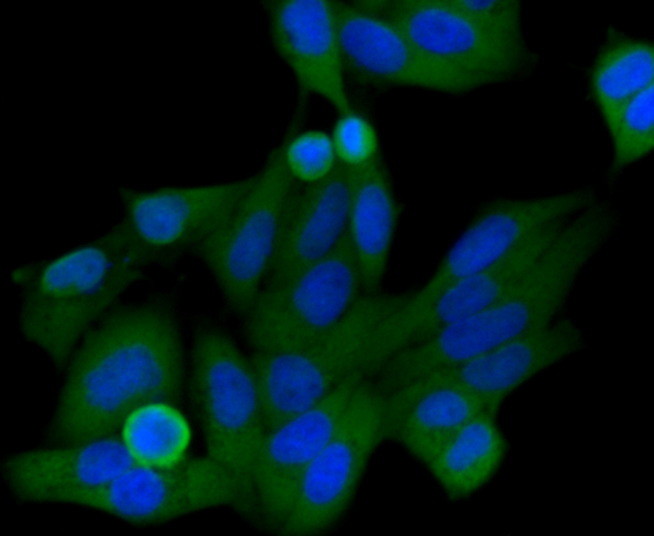 Immunocytochemical staining of Hela cells using anti-HIF-1 alpha rabbit polyclonal antibody.  .