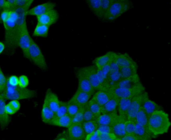 Immunocytochemical staining of SW480 cells using anti-HIF-1 alpha rabbit polyclonal antibody.  .